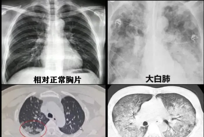 2023年度最全体重健康基准图表，或你的真实体型无需担忧，停止盲目轻体吧！